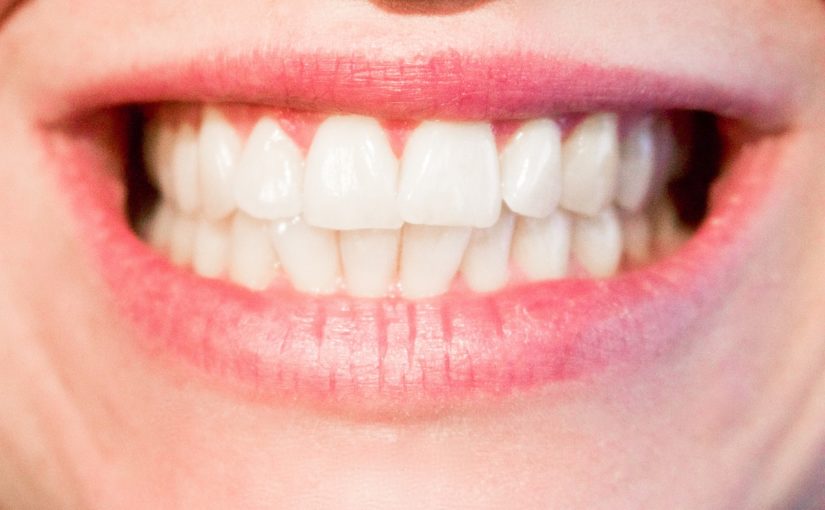 Obecna technologia wykorzystywana w salonach stomatologii estetycznej być może spowodować, że odbierzemy prześliczny uśmiech.